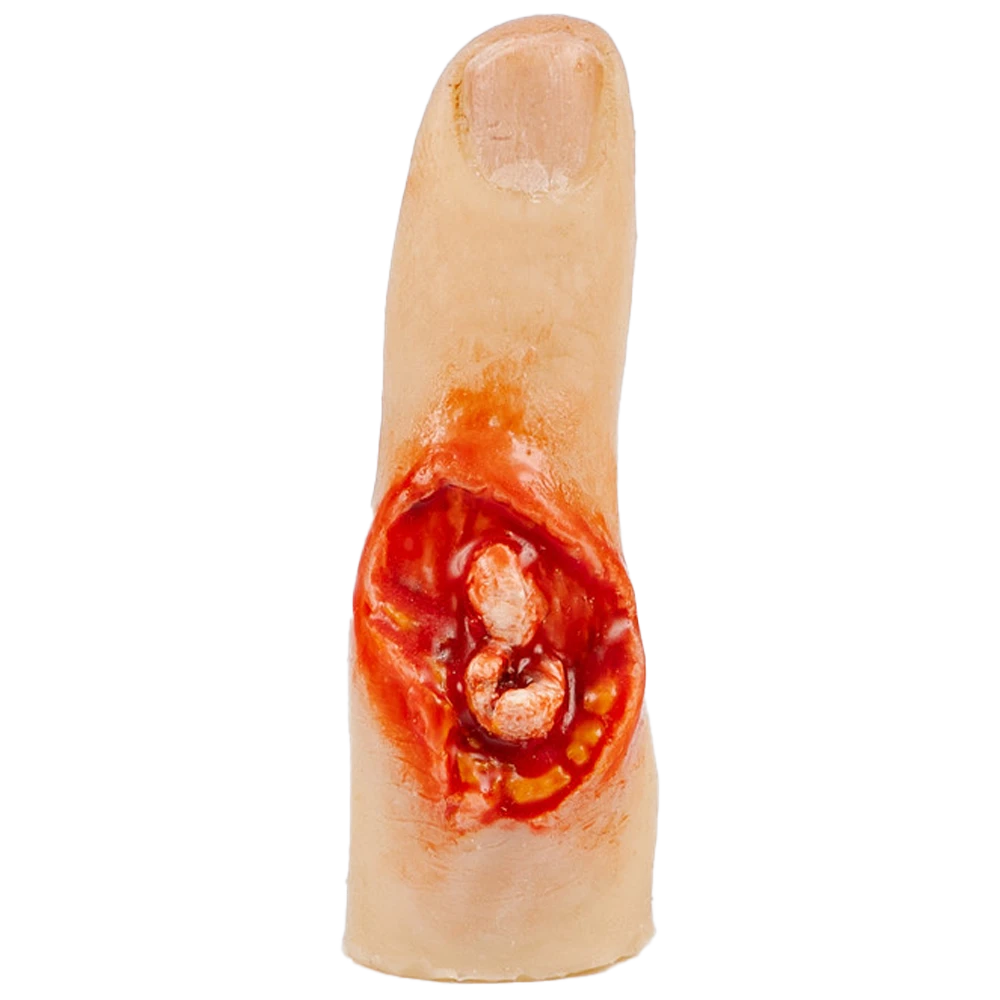 TraumaSim Finger Glove - Exposed Bone Injury